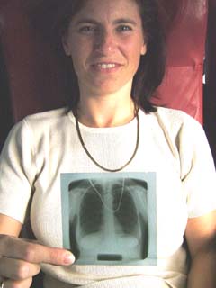 A woman sitting in a train seat holding a small chest x-ray in front of her