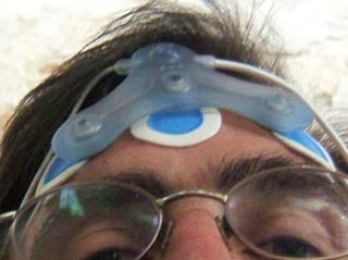 Three electrodes are attached to my forehead.  A plastic attachment with wires is connected to the electrodes.